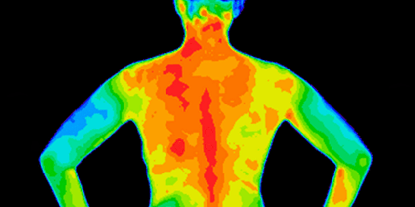 Thermography Image