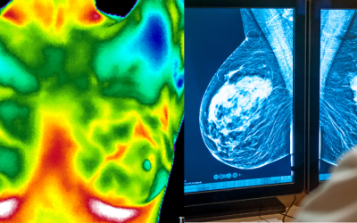 Thermography vs. Mammography: Understanding the Difference Without Fear